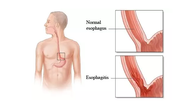 ca88手机客户端(安卓/苹果)CA88会员登录入口