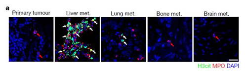 转入小鼠模子获得相同的试验效果，，，，且在转移爆发前NET已在肝脏聚积。。。。。