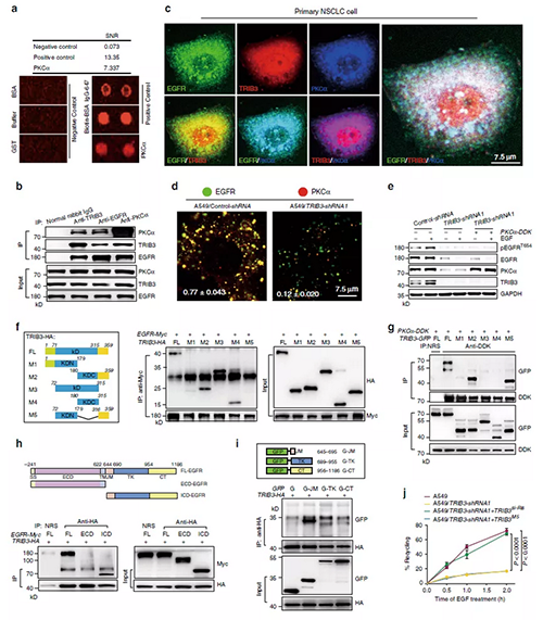 TRIB3与EGFR相互作用以增进PKCα介导的EGFR磷酸化