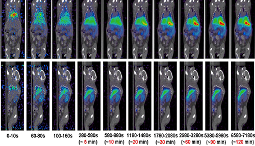 CA88PET/CT分子影像手艺平台