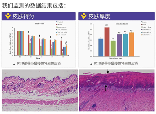 CA88建设的特应性皮炎及湿疹模子监测数据效果