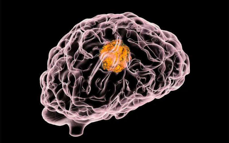 CA88助力 | 璧辰医药ABM-1310获美国FDA孤儿药资格认证，，，，，，用于治疗携带BRAF V600突变的脑胶质母细胞瘤患者